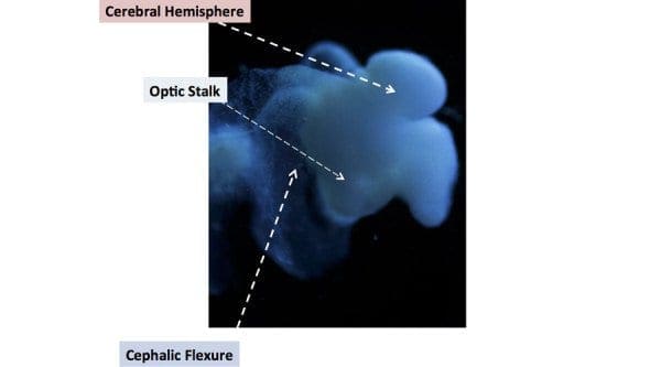 55d49a51c4618819638b4567